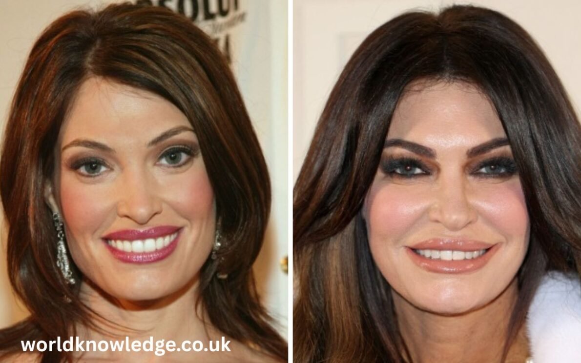 kimberly guilfoyle before and after kimberly guilfoyle before and after