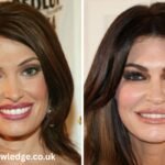 kimberly guilfoyle before and after