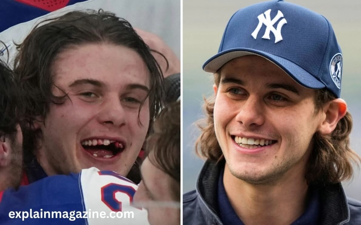 jack hughes teeth