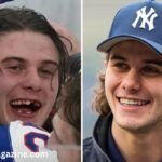 jack hughes teeth